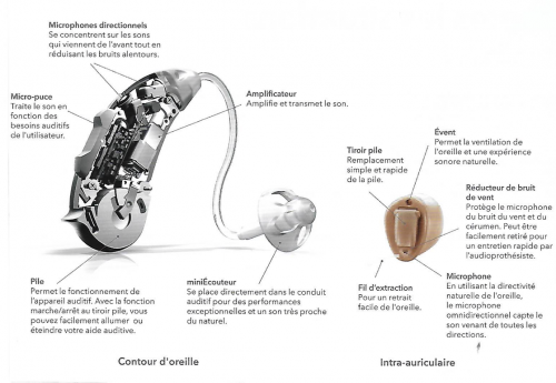 Comment mettre un appareil auditif dans l'oreille ?