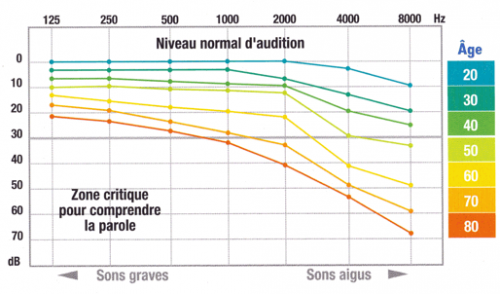 perte auditive presbyacousique problème d'audition trouble auditif