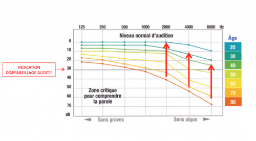 presbyacousie et assistant d'écoute préréglé